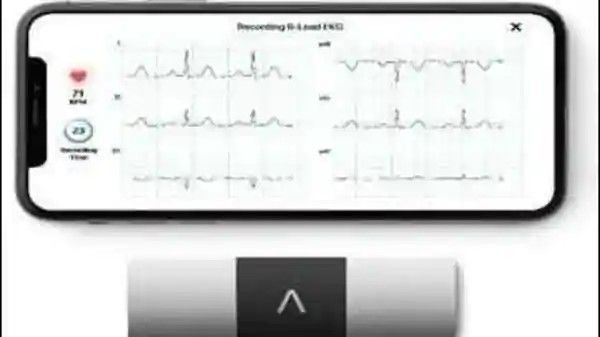 US firm AliveCor taps India telemedicine market with ECG device